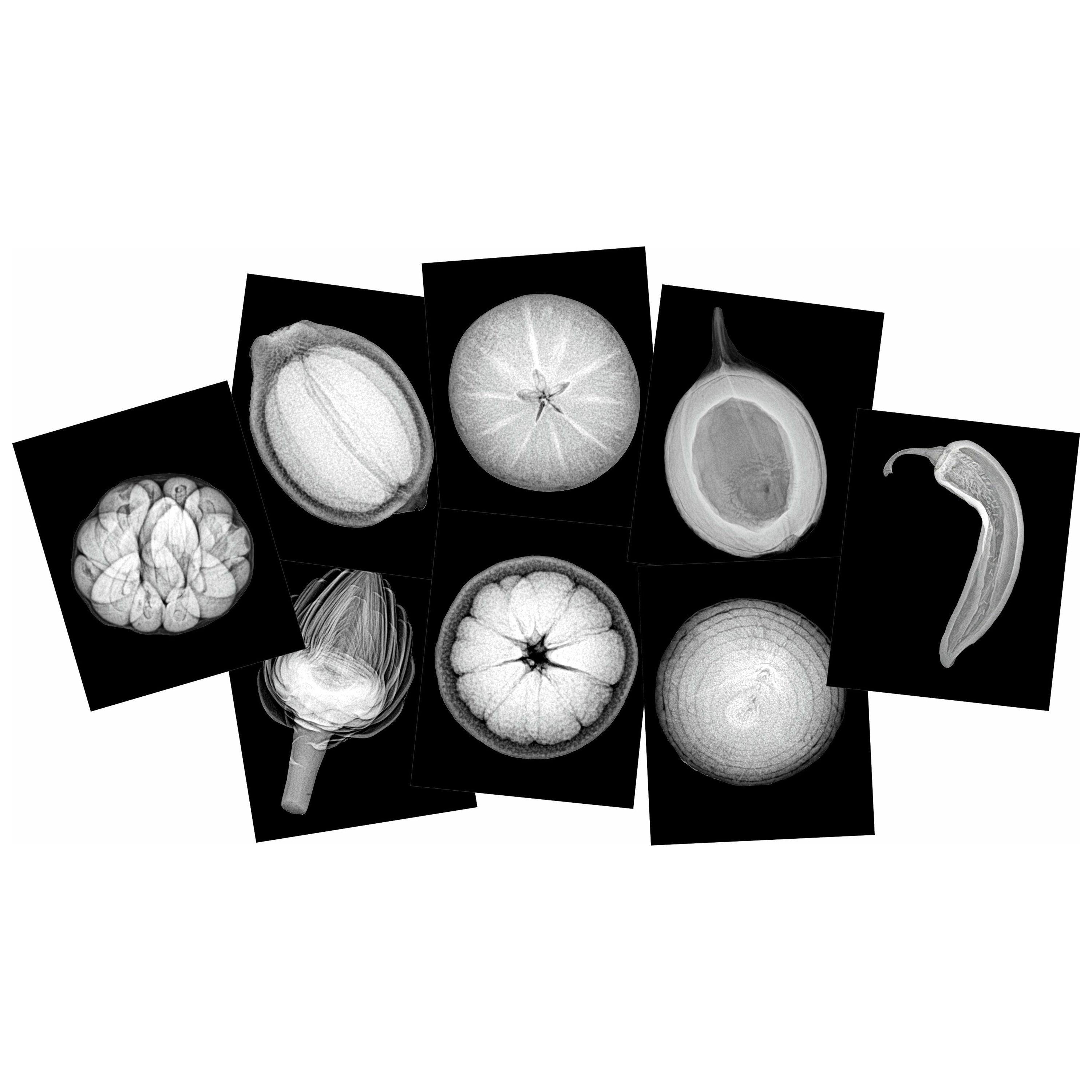 Set of black and white X-ray images on a white background