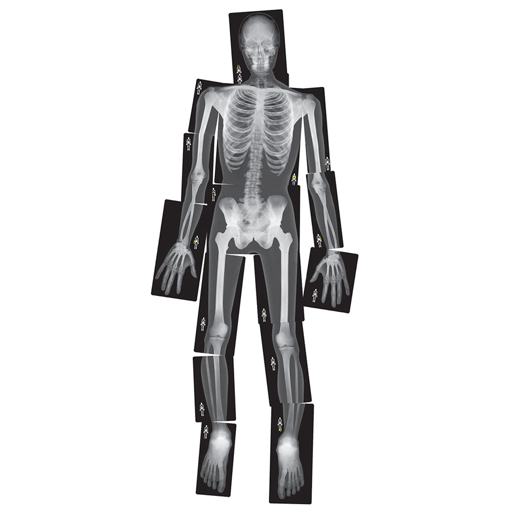 Human X-Rays