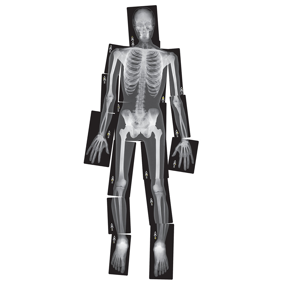 Human X-Rays
