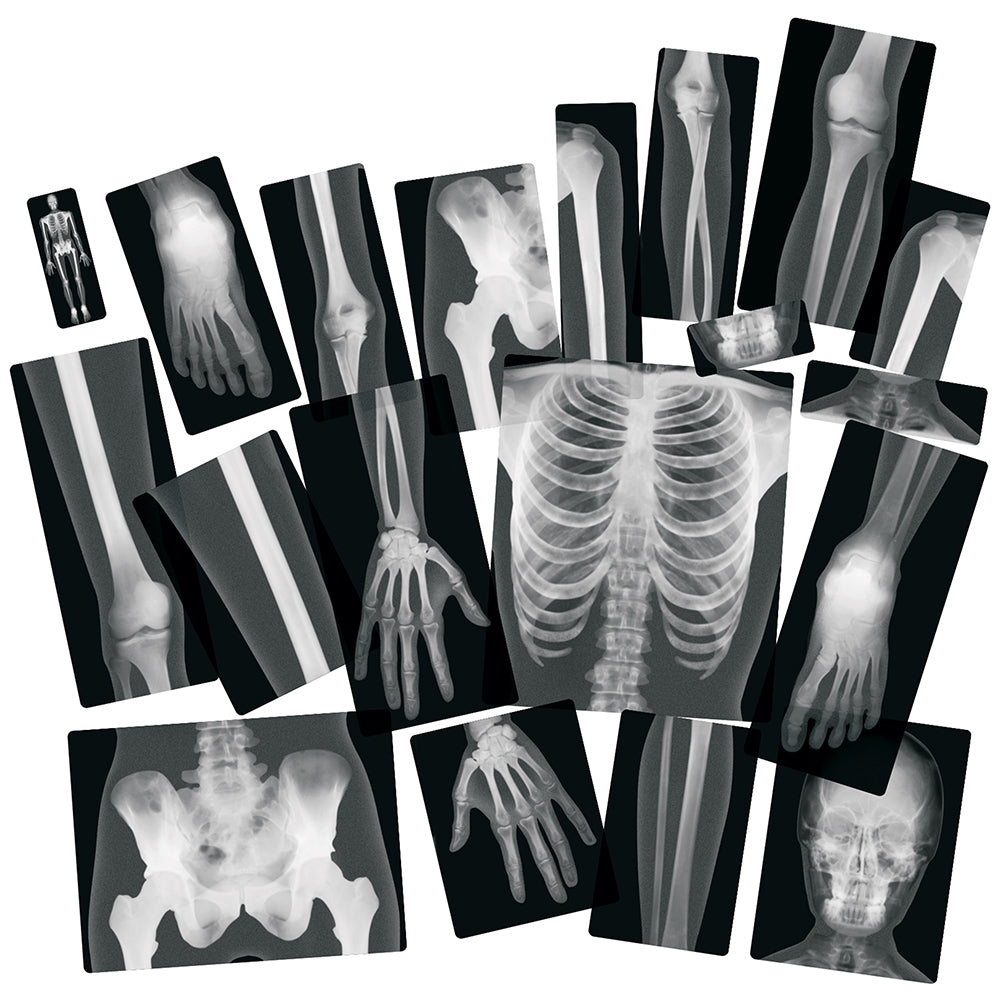 Human X-Rays